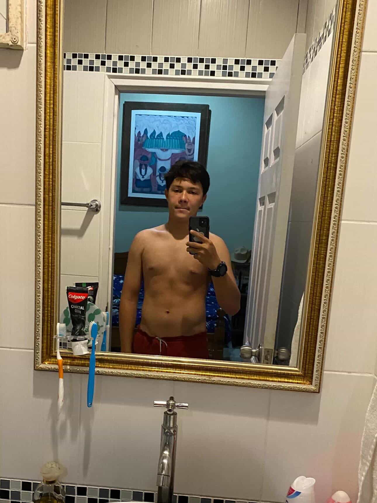 Patrick before